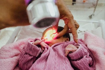 Dia de Conscientização contra Retinoblastoma: Teste do olhinho aumenta as chances de cura em 90%