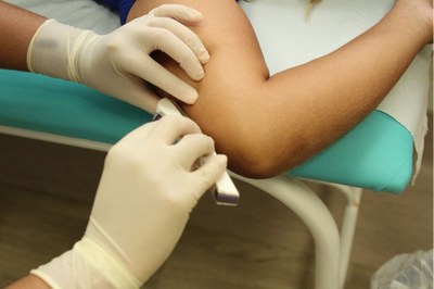 São Vicente abre 250 vagas para 6º Mutirão do Implanon