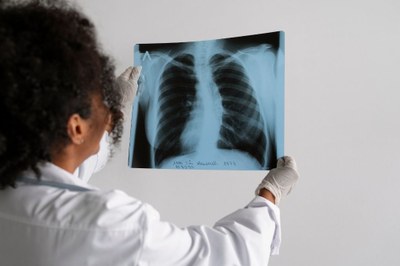 São Vicente amplia atendimento e passa a oferecer tratamento contra tuberculose em todas as UBSs e ESFs