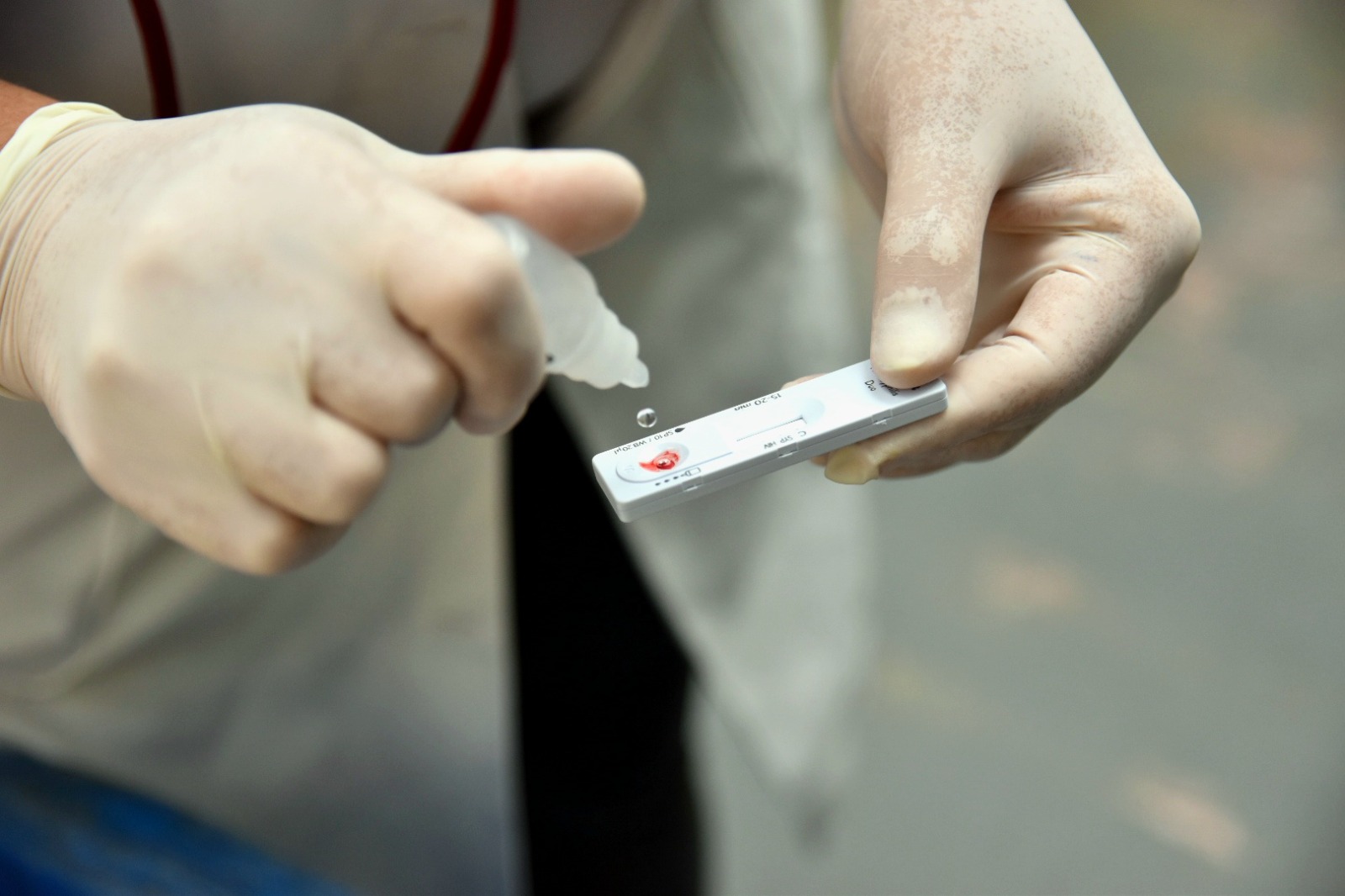 São Vicente é a cidade com maior queda de casos de HIV na Baixada